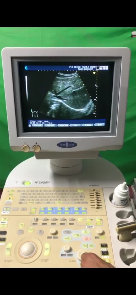 Anna Terexovaning porno fotosuratlarini tomosha qiling